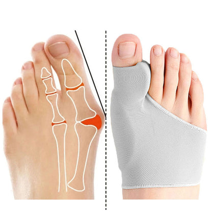 OrthoFix -  Bunion Correctie - Teenseparator - Gelpad voetpijn corrector